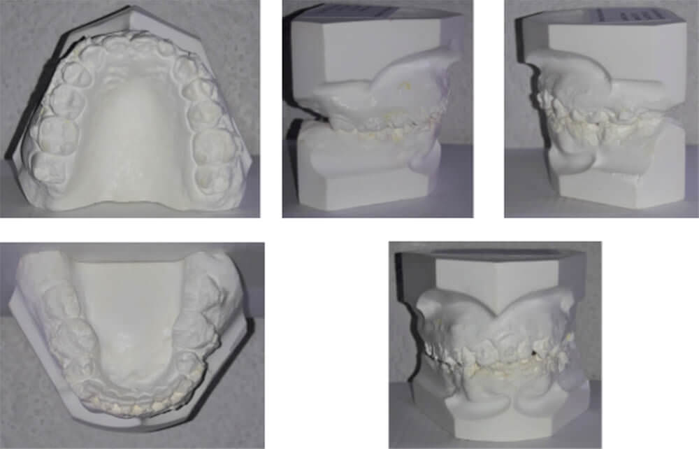 Fig. 7 Análisis de modelos de estudios intermedios