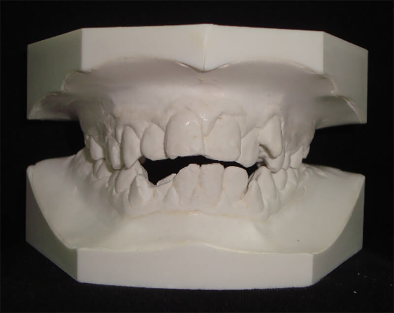 Fig. 3 Modelos de estudio