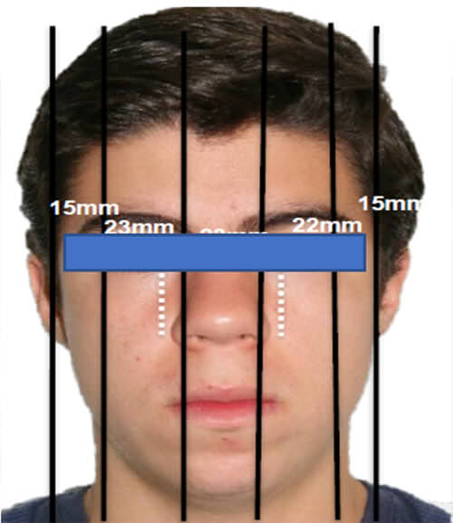 Fig. 1 Extraoral