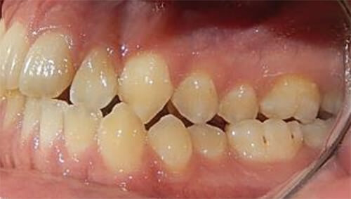 Fig. 6  lateral izquierda