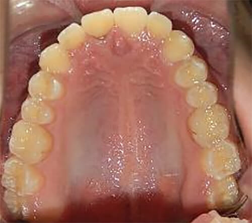 Fig. 7 vista oclusal superior