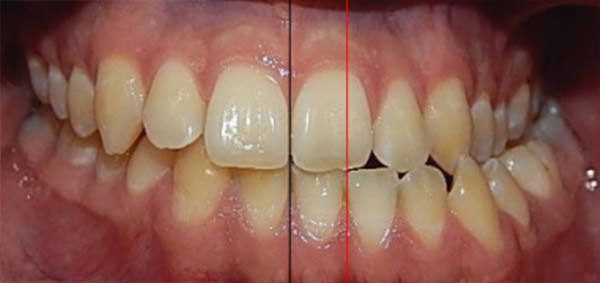 Fig. 3 intraoral frente