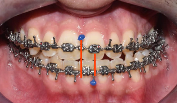 Fig. 5 Intraoral de frente