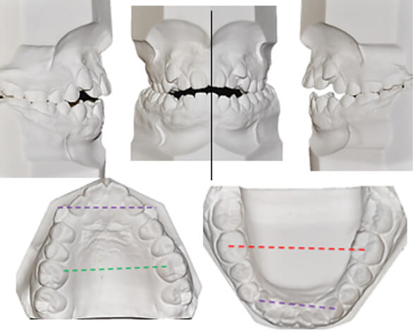 Figura 5. Análisis de modelos