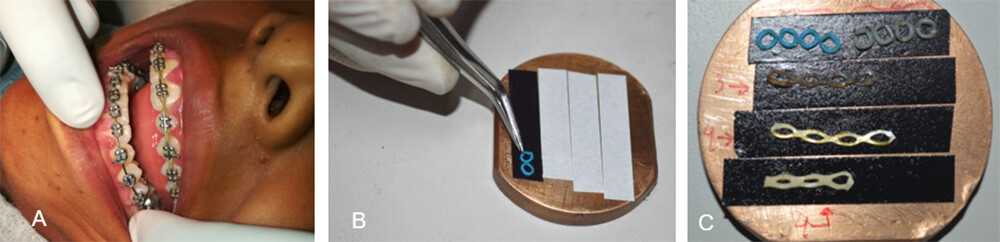 Figura 1. A) Retiro de cadenas elastoméricas de un paciente con labio y paladar hendido, B) y C) Fijación de los módulos elastoméricos al portamuestra mediante cinta adhesiva conductora de carbono de doble cara.
