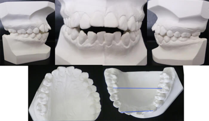 Figura 3: Modelos de estudio iniciales