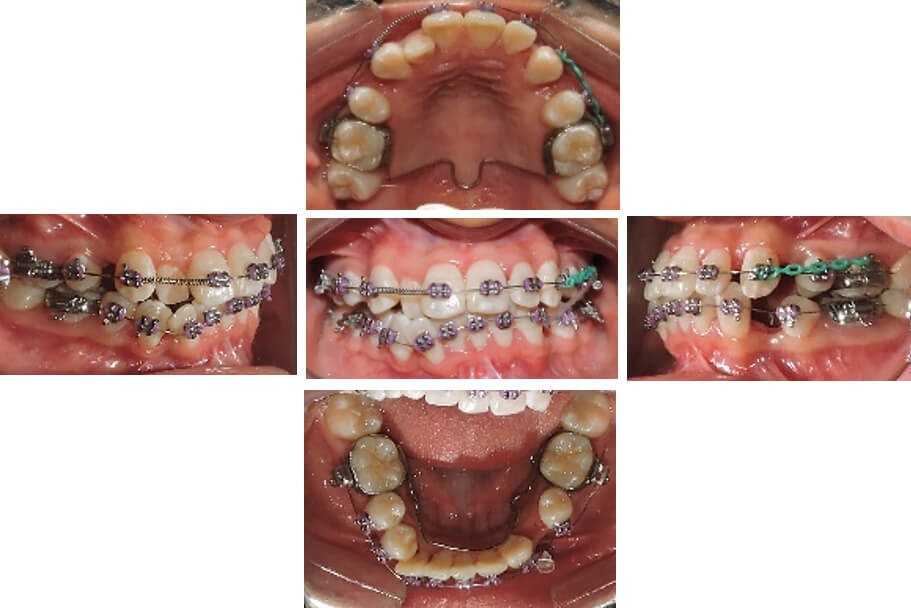 Figura 9. Fotos evolución de tratamiento