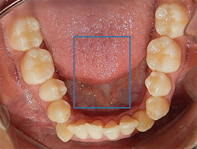 Fig. 5 Oclusal inferior