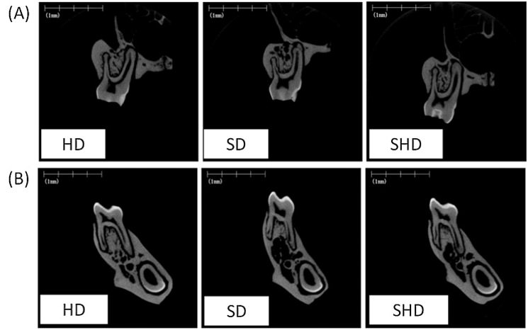 Fig 2 Imágenes representativas de micro-CT de la sección transversal frontal de la primera región molar en el maxilar (A) y la mandíbula (B).HD, dieta dura. SD, dieta en polvo (blanda). SHD, cambie de dietas suaves a duras. (Yuko Fujita y Kenshi Maki 2018)