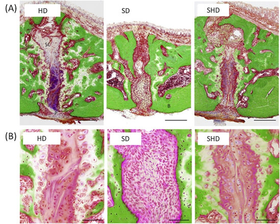 Fig 3.Imágenes histológicas representativas de la placa dura por tinción de Villanueva Goldner.HD, dieta dura. SD, dieta en polvo (blanda). SHD, cambie de dietas suaves a duras. Sección transversal frontal del área de la región de sutura del paladar medio (A). P, periostio dentro de la región oral de la sutura del paladar medio, SC, sutura de cartílagos, B, hueso. Barra de escala = 200 μm. Mayores aumentos de la sutura del paladar medio (B). Barra de escala = 50 μm. (Yuko Fujita y Kenshi Maki 2008)