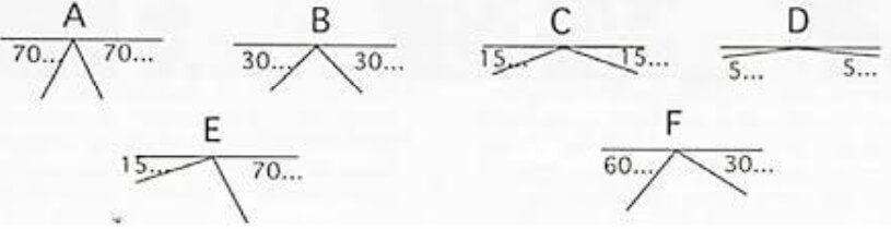 Figura 2. Esquema con las variantes de AFMP a distintas edades y en distintas anomalías. Fuente: Carbone, 2014