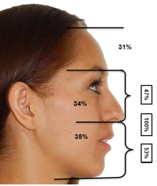 Fig.2 Perfil