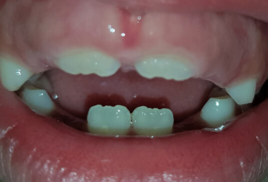 Figura 9