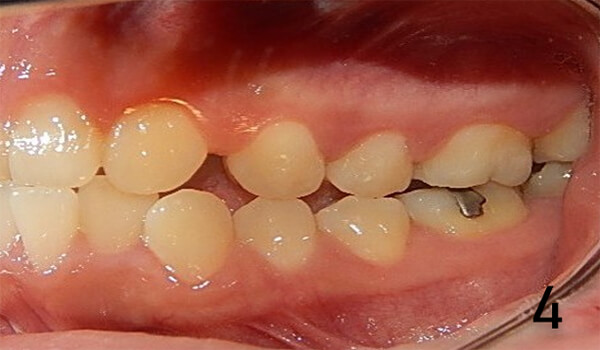 Fig. 4 Lado izquierdo inicio