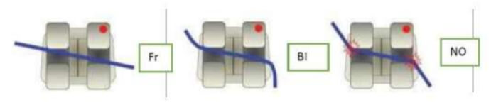 Fig.1. Resistencia al deslizamiento.  Fr. Fricción, BI. Binding,  NO. Notching. Imagen tomada de trabajo de grado de Barragan