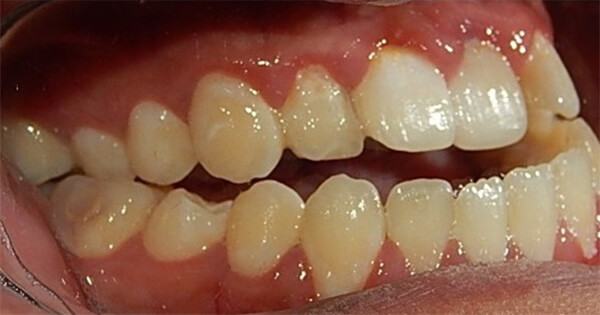 Fig 1. Vista lateral derecha