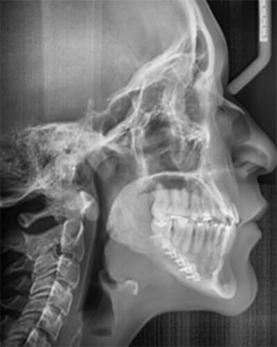 Fig. 14 Rx lateral final