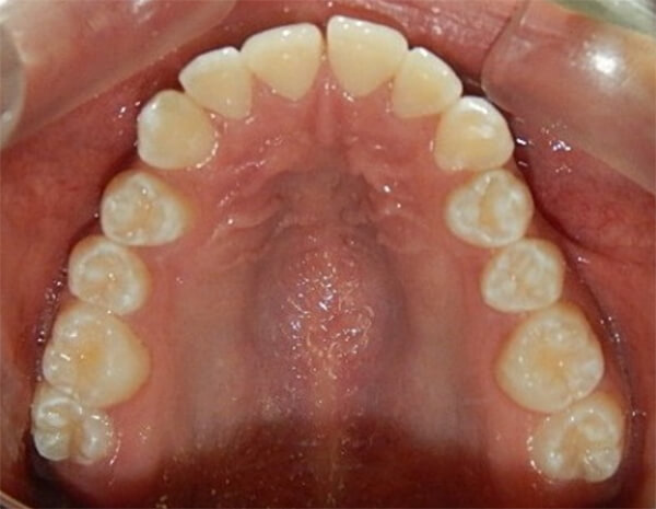 Fig. 3 Oclusal superior