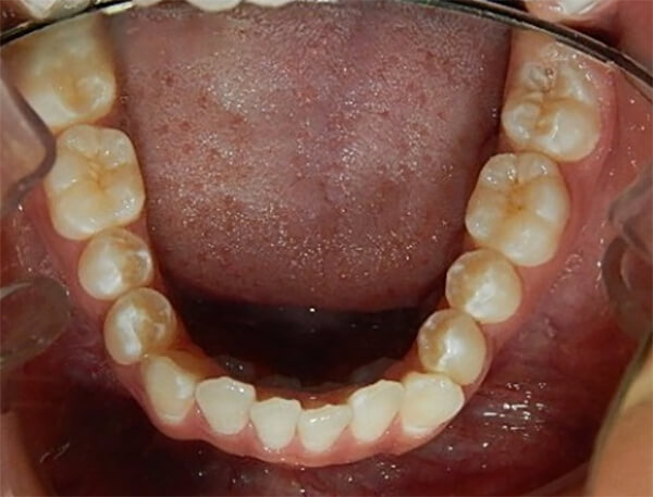 Fig. 4 Oclusal inferior