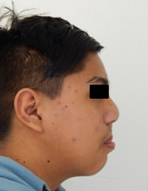 Fig. 11 perfil final