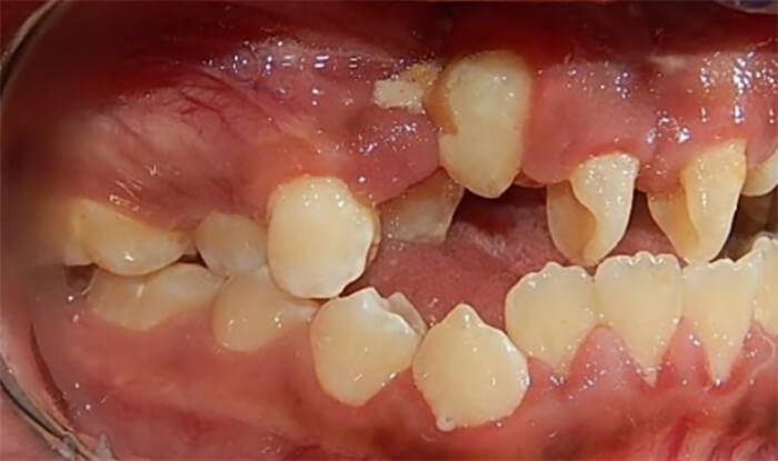 Fig. 4 lateral derecha