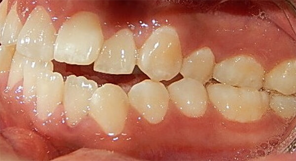 Fig 2. Intraoral frente, derecha, izquierda