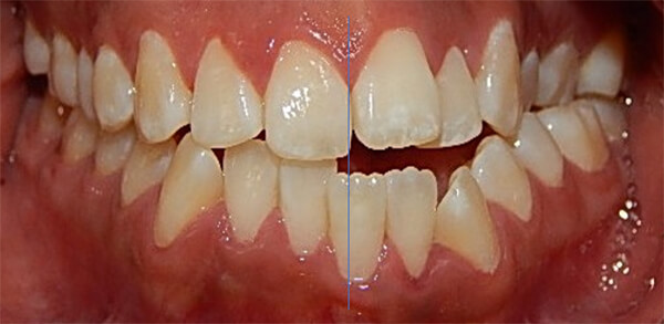 Fig 2. Intraoral frente, derecha, izquierda