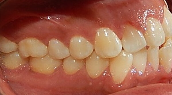 Fig 2. Intraoral frente, derecha, izquierda