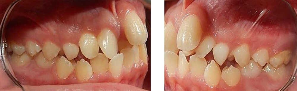 Fig 1. Vista lateral derecha / Fig 2. Vista lateral izquierda