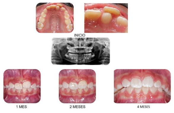 Imagen 2