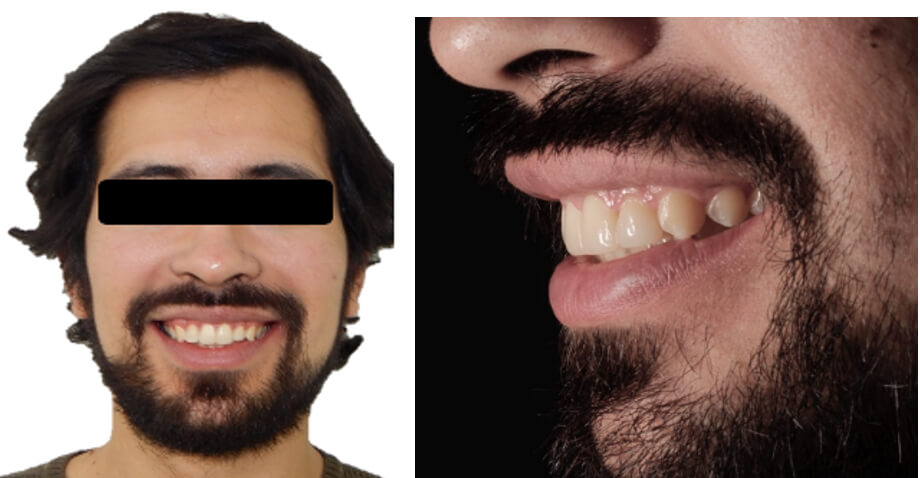 Fig.12 final sonrisa