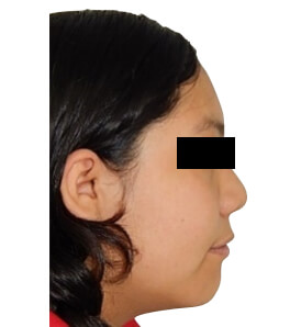 Fig. 2  perfil