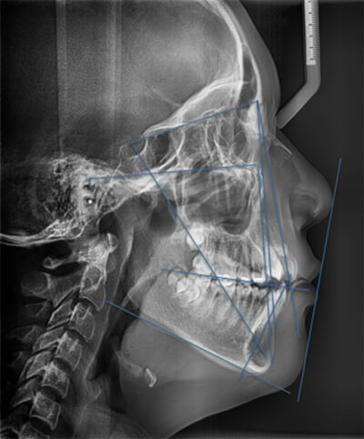Fig. 4 Rx Lateral de cráneo