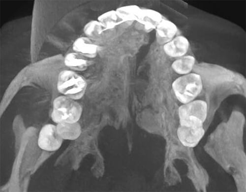 Fig. 6 Corte Axial