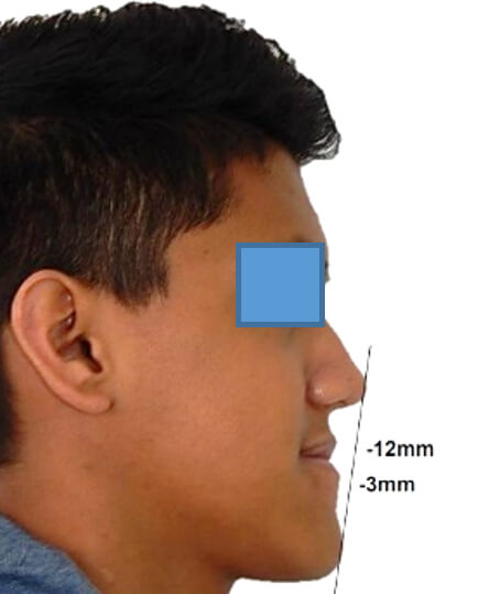 Fig. 2 Perfil