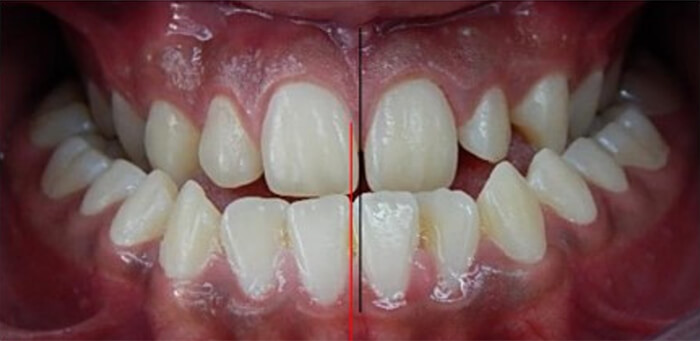 Fig. 3 Intraoral de frente