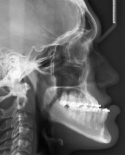 Fig. 8 Radiografía Lateral