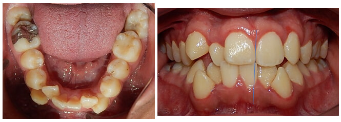 Fig. 2 Oclusal inferior, frente