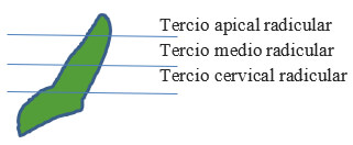 Figura 6: Esquema tercios radiculares