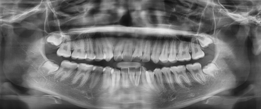 Fig. 9 radiografía panorámica