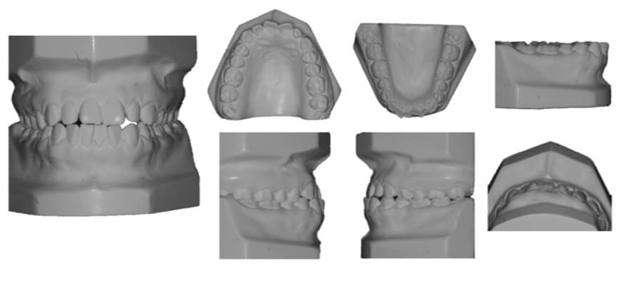 Figura 2. Imágenes de modelos de estudio iniciales.