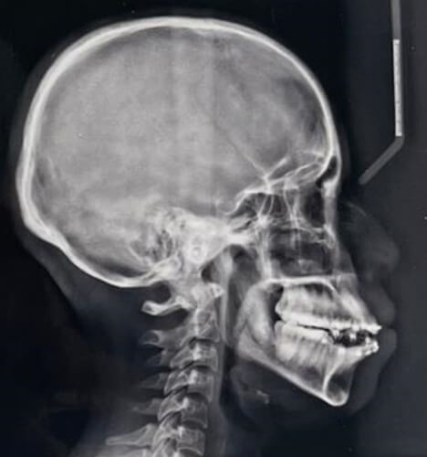 Fig. 6 Corte sagital