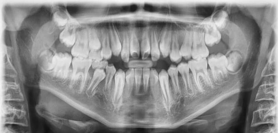 Fig. 7 Corte coronal