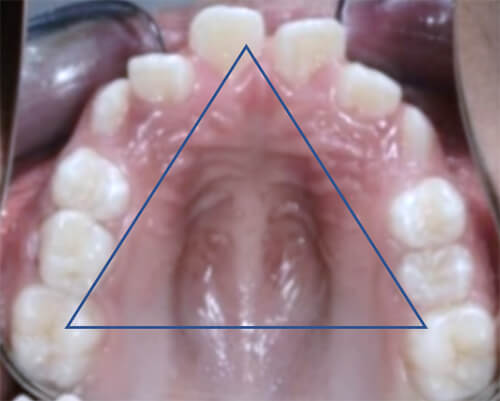 Fig. 11 Oclusal superior