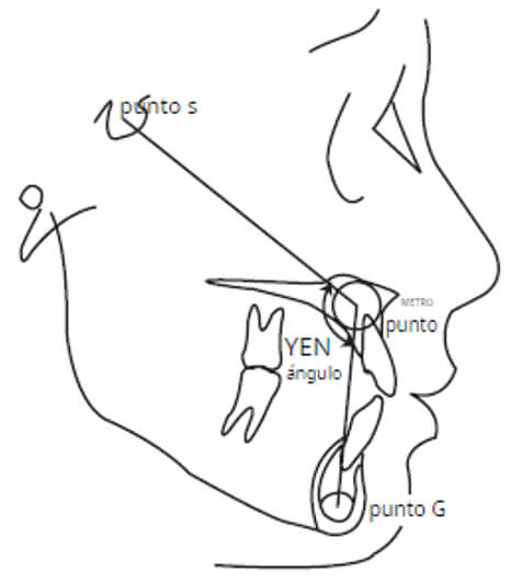 Figura 2 Ángulo Yen ( Neela, PK et al. 2009) (18)