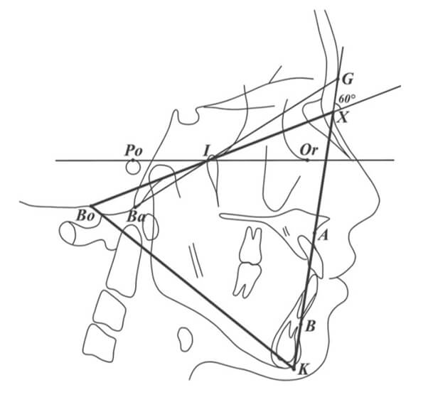 Figura 5 Triángulo G ( Li, Boxiu et al. 2022)