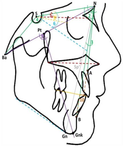 Figura 7 Parámetros cefalométricos esqueléticos utilizados como variables predictoras guía para calcular el ángulo ANB individualizado y la evaluación de Wits (Paddenberg, E., Proff, P. & Kirschneck, C.  et al, 2021):  (1) SNA, (2) SNB, (3) ANB, (4) NSBa, (5) NL-NSL, (6) ) ML-NSL, (7) índice (Hasund) = NSp'/Sp'Gn, (8) eje facial (Ricketts), (9) SN-Occl, (10) Wits