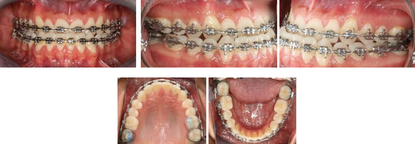 Fig. 8. Frente intraoral, lateral derecha vista oclusal superior