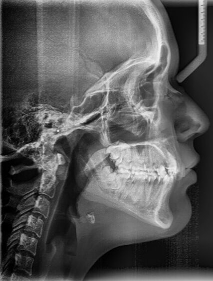 Fig. 2 Radiografía cefálica lateral