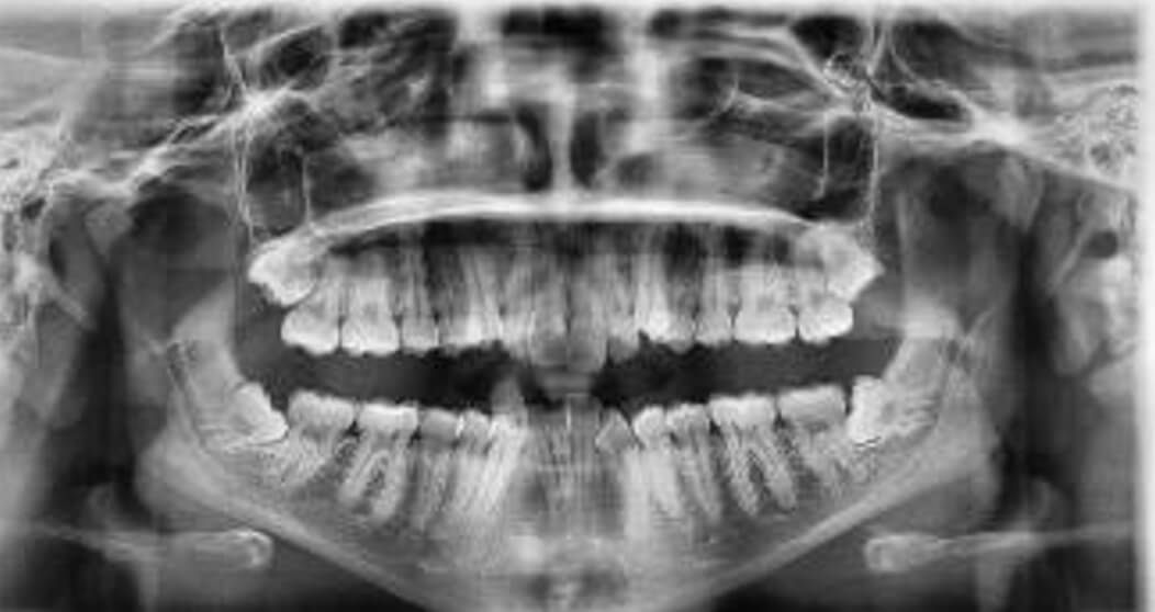 Fig. 3 Radiografía panorámica